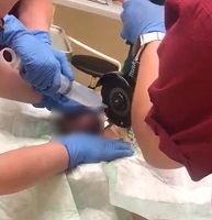 cockring
